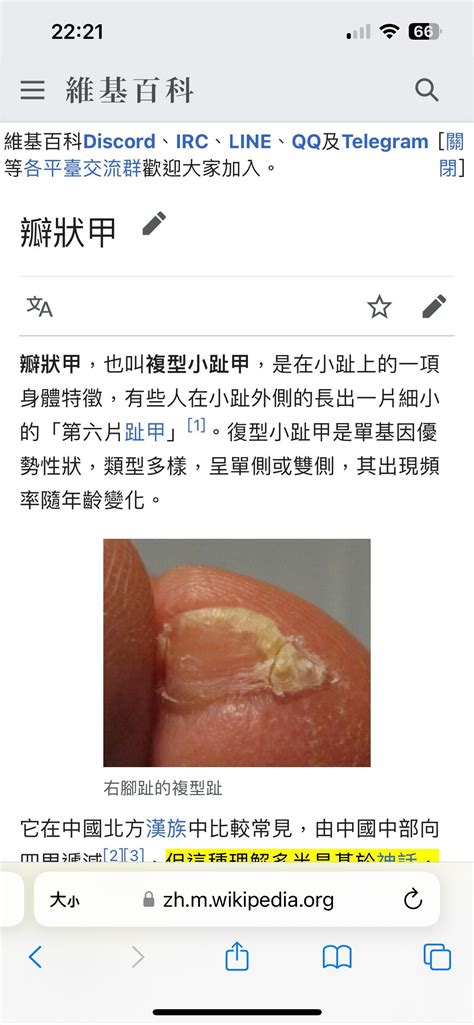 漢人腳指甲|漢人特徵？腳「小拇指」兩瓣！生物師破謠：跟直髮一樣是顯性基因